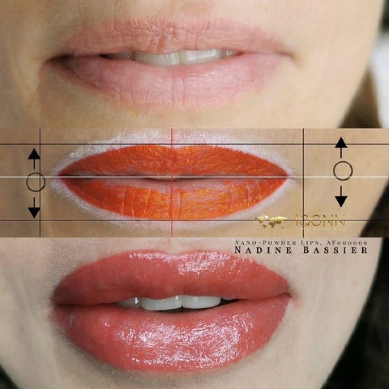 before-after-lips